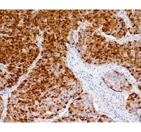 Immunohistochemistry - Anti-Liver Arginase Antibody [IHC118] (A324568) - Antibodies.com