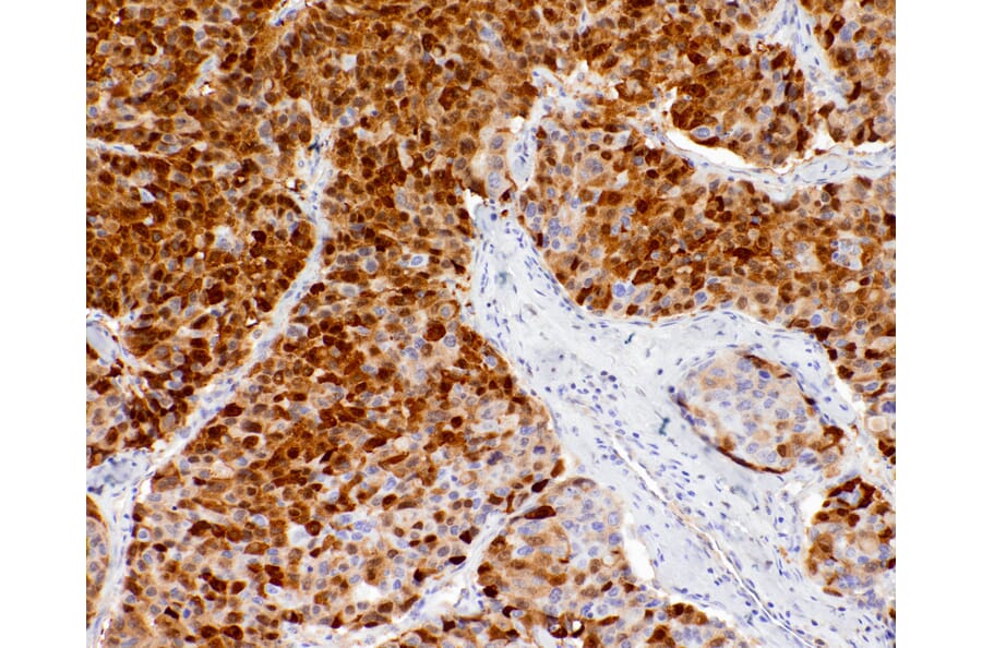 Immunohistochemistry - Anti-Liver Arginase Antibody [IHC118] (A324568) - Antibodies.com