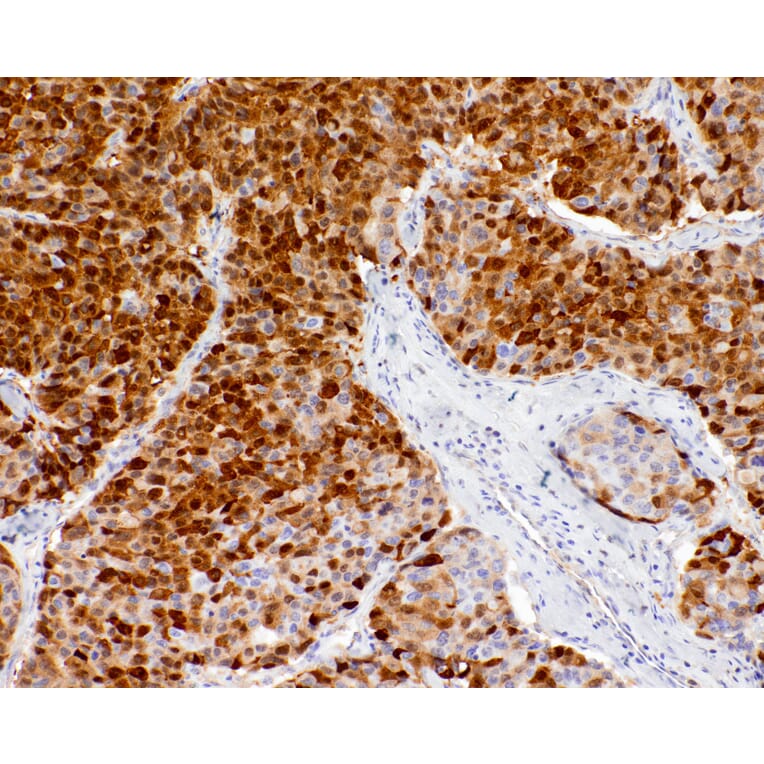 Immunohistochemistry - Anti-Liver Arginase Antibody [IHC118] (A324568) - Antibodies.com