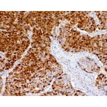 Immunohistochemistry - Anti-Liver Arginase Antibody [IHC118] (A324568) - Antibodies.com