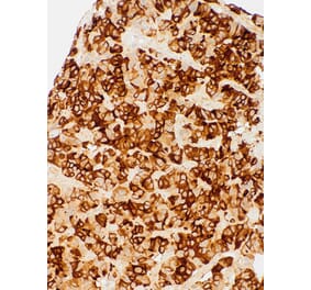 Immunohistochemistry - Anti-TSH Antibody [IHC679] (A324569) - Antibodies.com