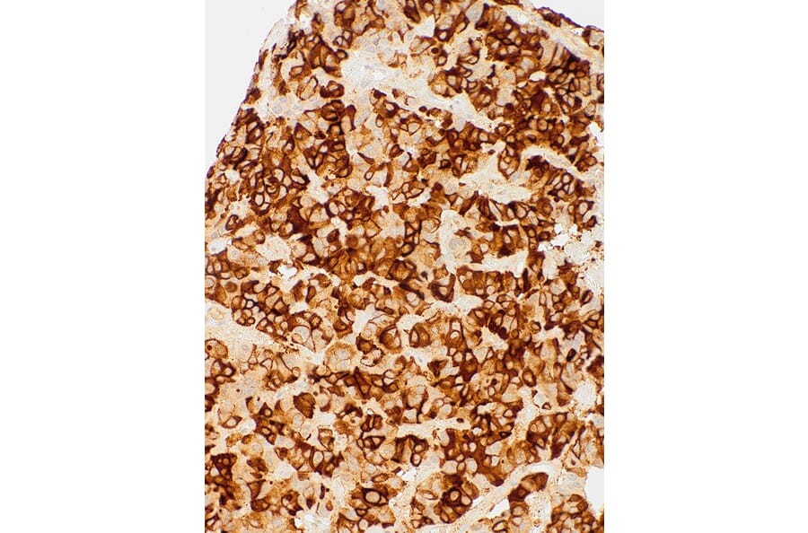 Immunohistochemistry - Anti-TSH Antibody [IHC679] (A324569) - Antibodies.com