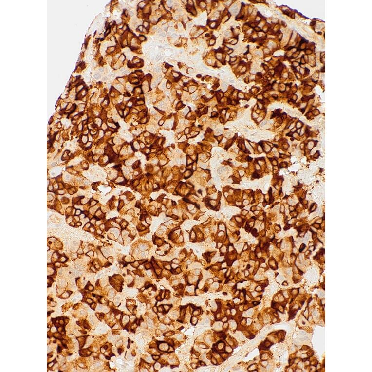 Immunohistochemistry - Anti-TSH Antibody [IHC679] (A324569) - Antibodies.com