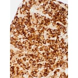 Immunohistochemistry - Anti-TSH Antibody [IHC679] (A324569) - Antibodies.com