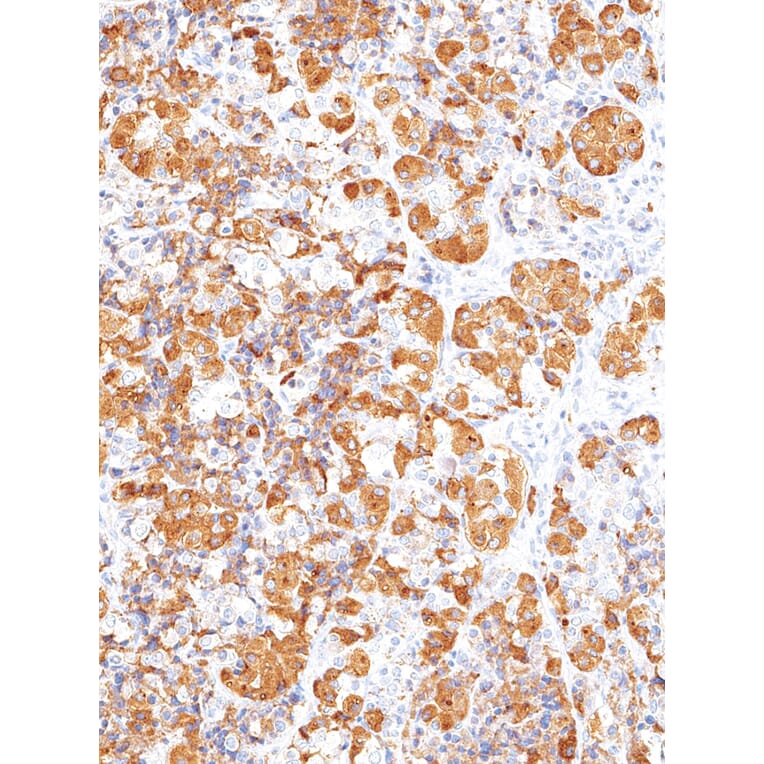 Immunohistochemistry - Anti-ACTH Antibody [IHC503] (A324570) - Antibodies.com