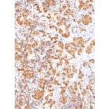 Immunohistochemistry - Anti-ACTH Antibody [IHC503] (A324570) - Antibodies.com