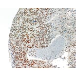 Immunohistochemistry - Anti-ATRX Antibody [IHC703] (A324571) - Antibodies.com