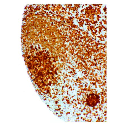 Immunohistochemistry - Anti-BOB1 Antibody [IHC060] (A324572) - Antibodies.com