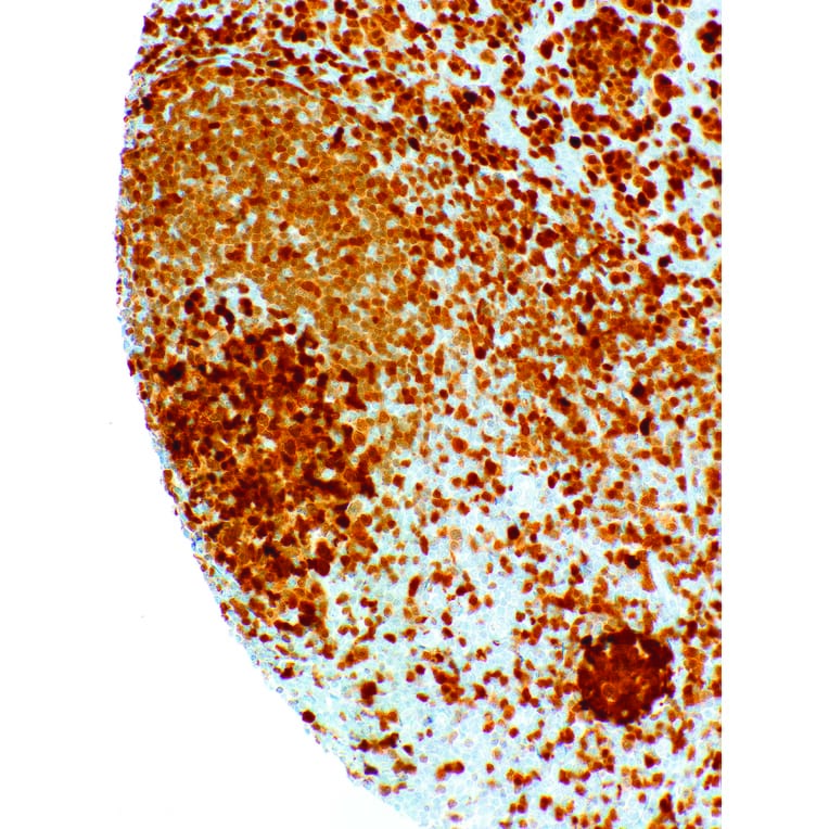 Immunohistochemistry - Anti-BOB1 Antibody [IHC060] (A324572) - Antibodies.com