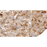 Immunohistochemistry - Anti-CD13 Antibody [IHC119] (A324573) - Antibodies.com