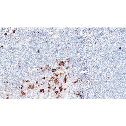 Immunohistochemistry - Anti-CD16 Antibody [IHC528] (A324576) - Antibodies.com