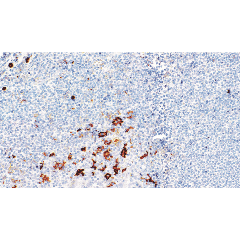 Immunohistochemistry - Anti-CD16 Antibody [IHC528] (A324576) - Antibodies.com