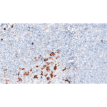 Immunohistochemistry - Anti-CD16 Antibody [IHC528] (A324576) - Antibodies.com