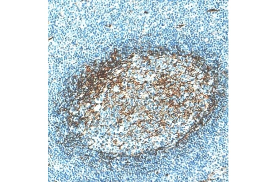 Immunohistochemistry - Anti-CD276 Antibody [IHC039] (A324577) - Antibodies.com
