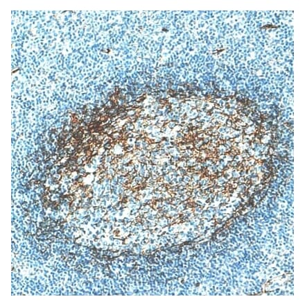 Immunohistochemistry - Anti-CD276 Antibody [IHC039] (A324577) - Antibodies.com