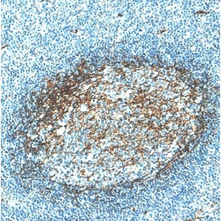 Immunohistochemistry - Anti-CD276 Antibody [IHC039] (A324577) - Antibodies.com