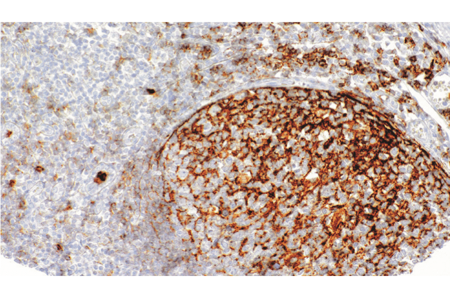 Immunohistochemistry - Anti-CD35 Antibody [IHC035] (A324578) - Antibodies.com