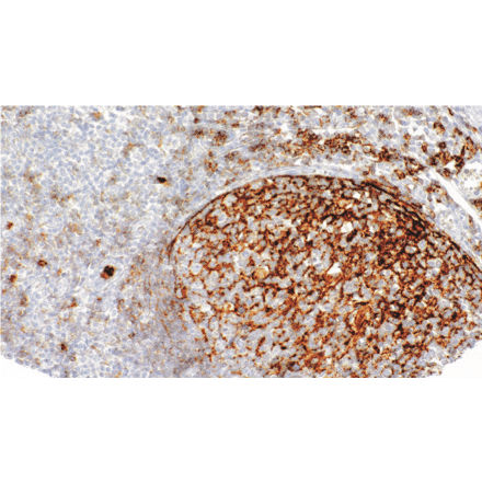Immunohistochemistry - Anti-CD35 Antibody [IHC035] (A324578) - Antibodies.com