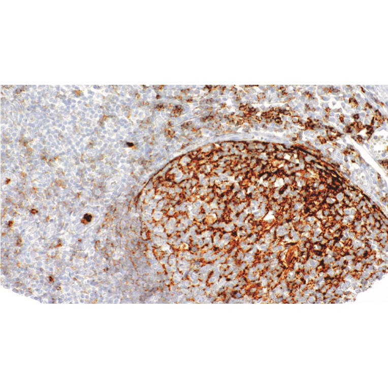 Immunohistochemistry - Anti-CD35 Antibody [IHC035] (A324578) - Antibodies.com