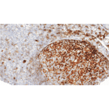 Immunohistochemistry - Anti-CD35 Antibody [IHC035] (A324578) - Antibodies.com