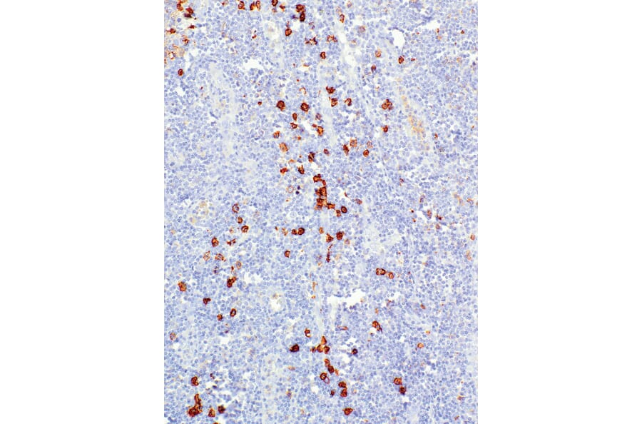 Immunohistochemistry - Anti-CD38 Antibody [IHC038] (A324579) - Antibodies.com