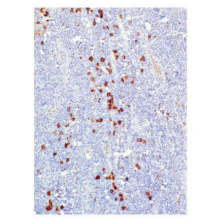 Immunohistochemistry - Anti-CD38 Antibody [IHC038] (A324579) - Antibodies.com