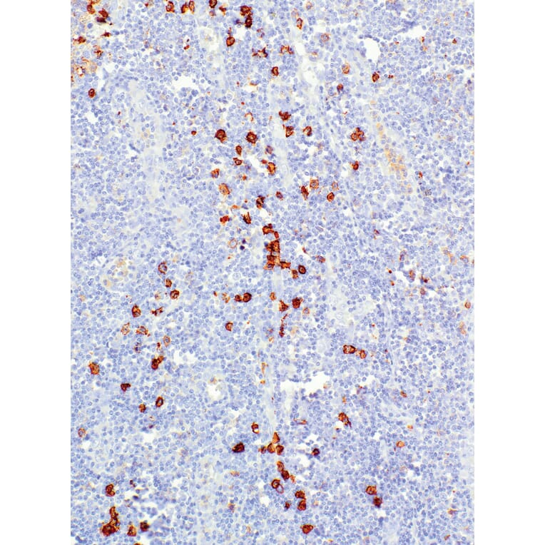 Immunohistochemistry - Anti-CD38 Antibody [IHC038] (A324579) - Antibodies.com