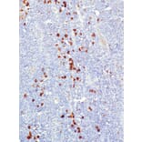 Immunohistochemistry - Anti-CD38 Antibody [IHC038] (A324579) - Antibodies.com