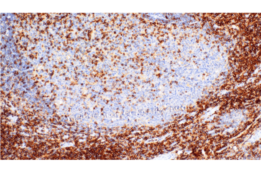 Immunohistochemistry - Anti-CD43 Antibody [IHC043] (A324580) - Antibodies.com