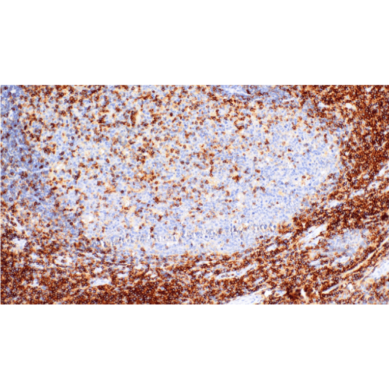 Immunohistochemistry - Anti-CD43 Antibody [IHC043] (A324580) - Antibodies.com
