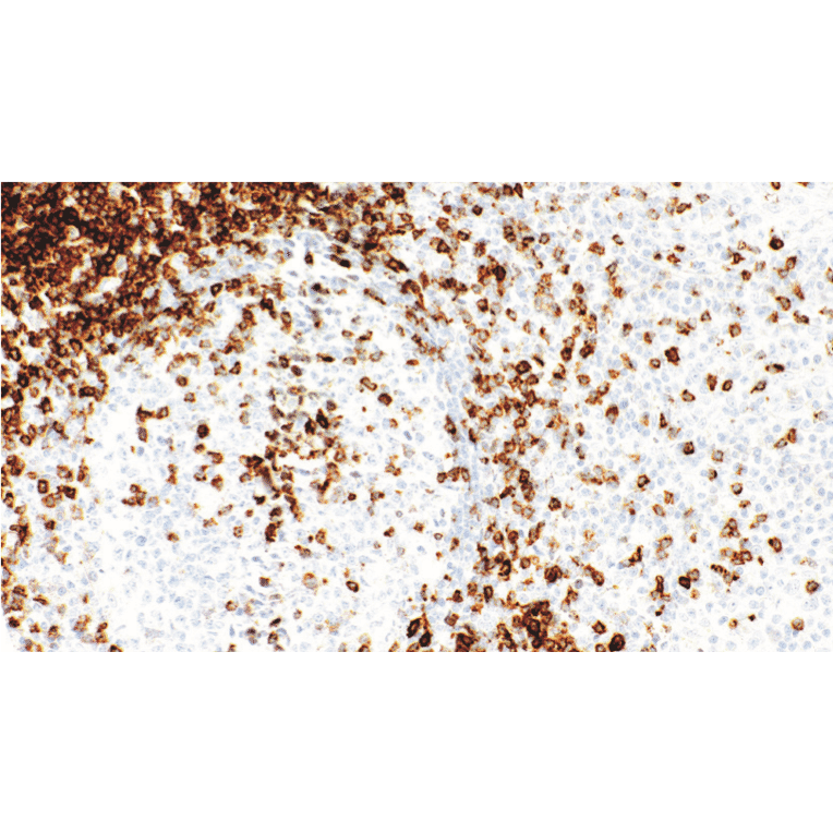 Immunohistochemistry - Anti-CD7 Antibody [IHC541] (A324581) - Antibodies.com
