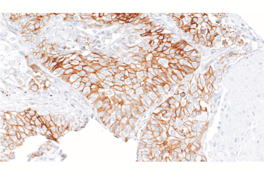 Immunohistochemistry - Anti-CD99 Antibody [IHC126] (A324582) - Antibodies.com
