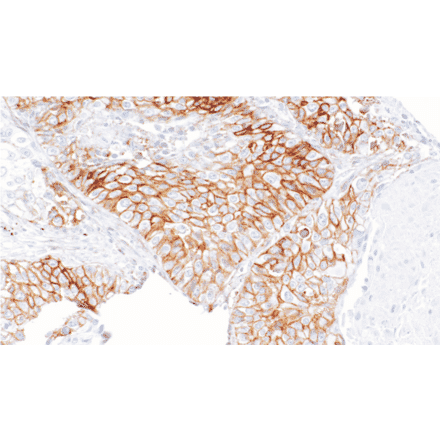 Immunohistochemistry - Anti-CD99 Antibody [IHC126] (A324582) - Antibodies.com
