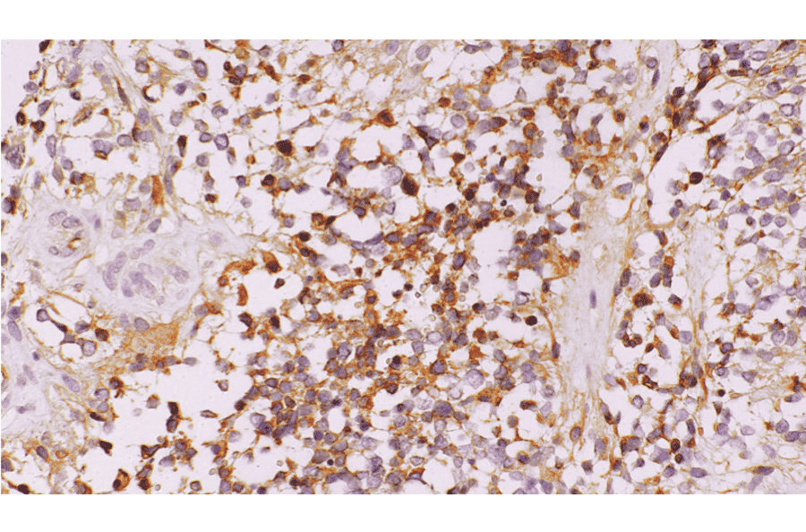 Immunohistochemistry - Anti-D-Dimer Antibody [IHC085] (A324585) - Antibodies.com