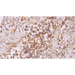 Immunohistochemistry - Anti-D-Dimer Antibody [IHC085] (A324585) - Antibodies.com