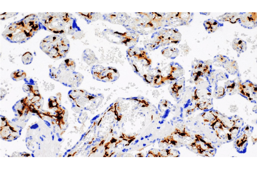 Immunohistochemistry - Anti-Factor XIIIa Antibody [IHC572] (A324586) - Antibodies.com