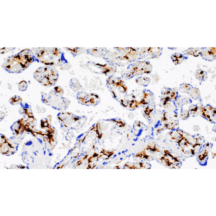 Immunohistochemistry - Anti-Factor XIIIa Antibody [IHC572] (A324586) - Antibodies.com