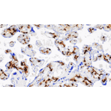 Immunohistochemistry - Anti-Factor XIIIa Antibody [IHC572] (A324586) - Antibodies.com