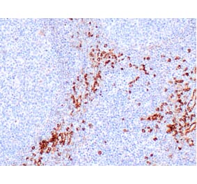 Immunohistochemistry - Anti-IL3RA/CD123 Antibody [IHC123] (A324593) - Antibodies.com