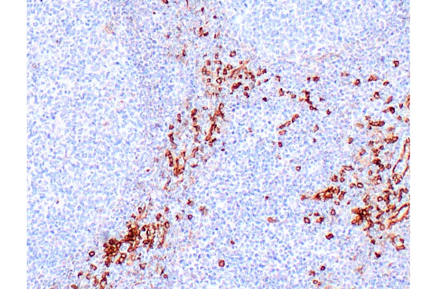 Immunohistochemistry - Anti-IL3RA/CD123 Antibody [IHC123] (A324593) - Antibodies.com