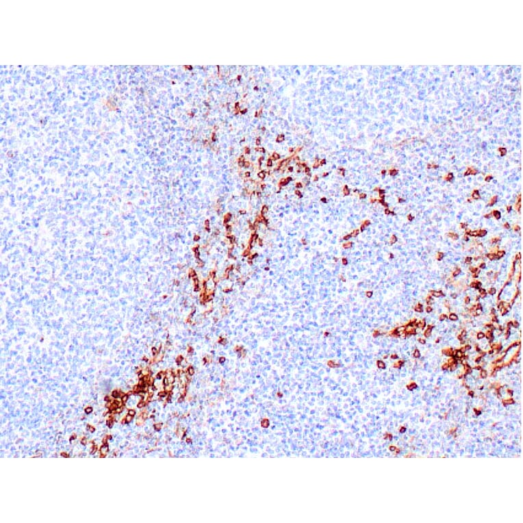 Immunohistochemistry - Anti-IL3RA/CD123 Antibody [IHC123] (A324593) - Antibodies.com