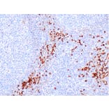Immunohistochemistry - Anti-IL3RA/CD123 Antibody [IHC123] (A324593) - Antibodies.com