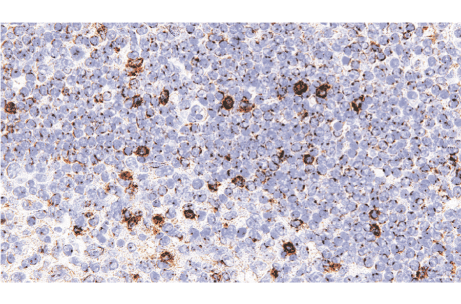 Immunohistochemistry - Anti-LAG-3 Antibody [IHC127] (A324595) - Antibodies.com