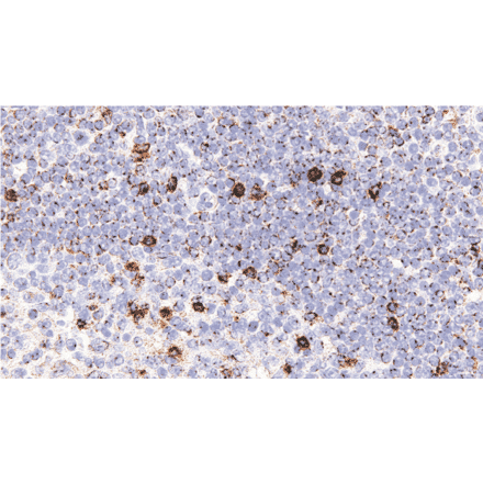Immunohistochemistry - Anti-LAG-3 Antibody [IHC127] (A324595) - Antibodies.com