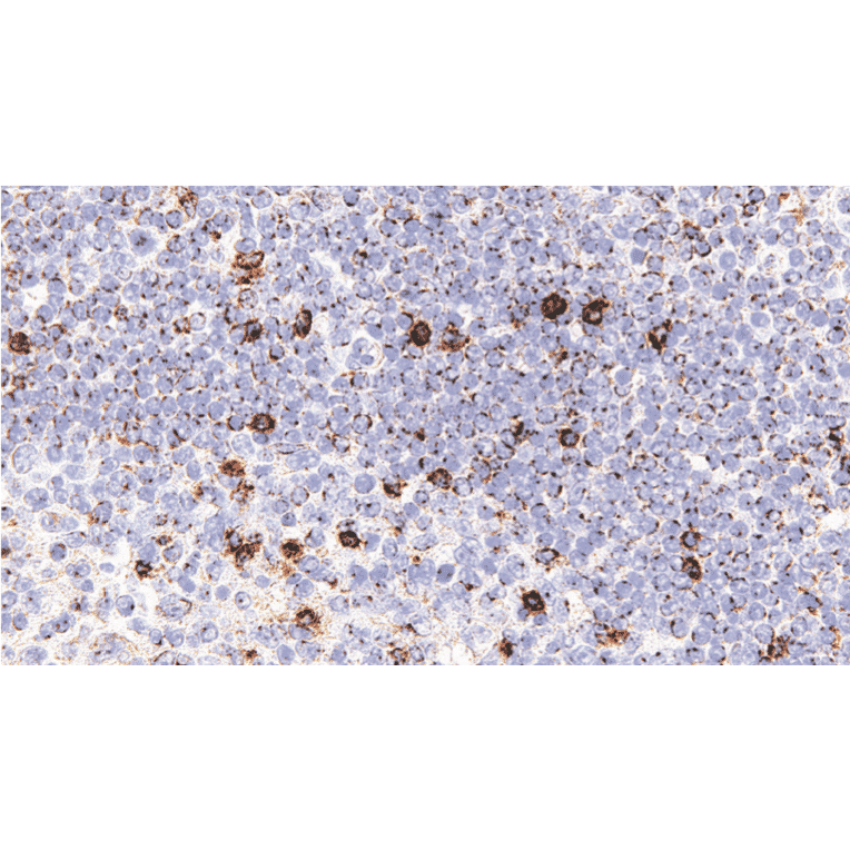 Immunohistochemistry - Anti-LAG-3 Antibody [IHC127] (A324595) - Antibodies.com