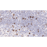 Immunohistochemistry - Anti-LAG-3 Antibody [IHC127] (A324595) - Antibodies.com