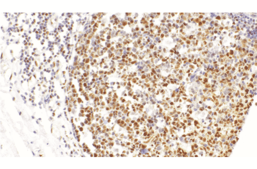 Immunohistochemistry - Anti-LMO2 Antibody [IHC102] (A324596) - Antibodies.com