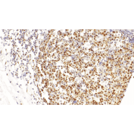 Immunohistochemistry - Anti-LMO2 Antibody [IHC102] (A324596) - Antibodies.com