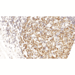 Immunohistochemistry - Anti-LMO2 Antibody [IHC102] (A324596) - Antibodies.com