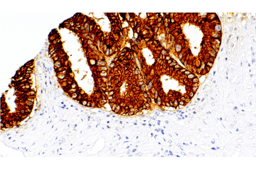 Immunohistochemistry - Anti-MUC2 Antibody [IHC122] (A324598) - Antibodies.com